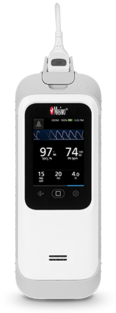 Rad-G Handheld Pulse Oximeter