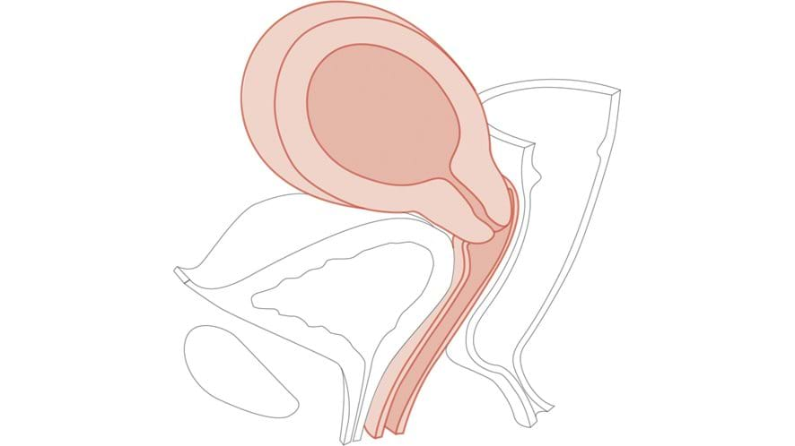 CFPT Module 6: 10 - 12 Weeks Pregnant